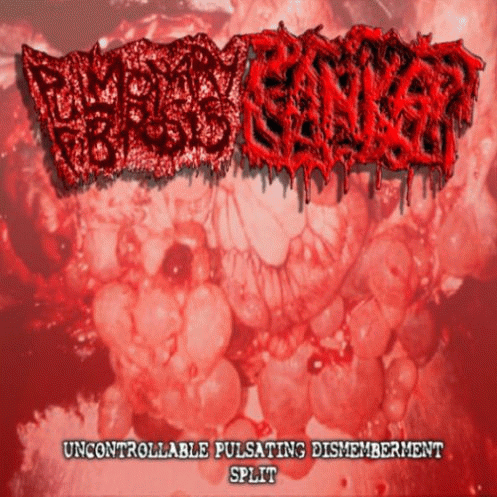 Canker (CAN) : Uncontrollable Pulsating Dismemberment Split